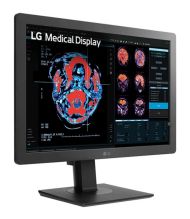 Monitor LG 24